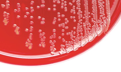 Molecular epidemiology of methicillin resistant Staphylococcus aureus: Emerging trends in the Arabian Gulf region