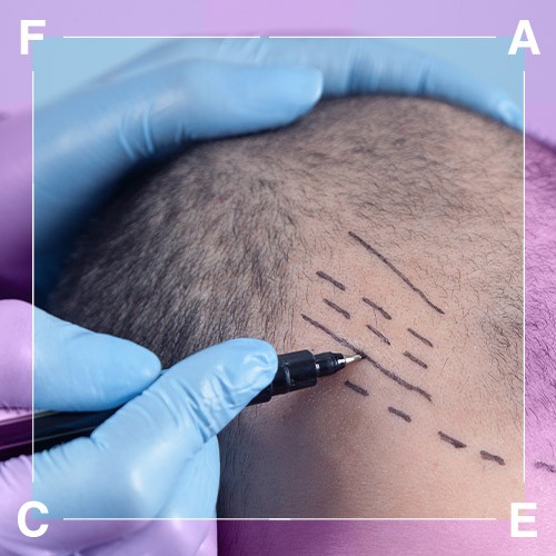 FACE Hair